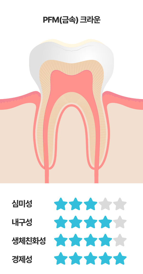 신경치료