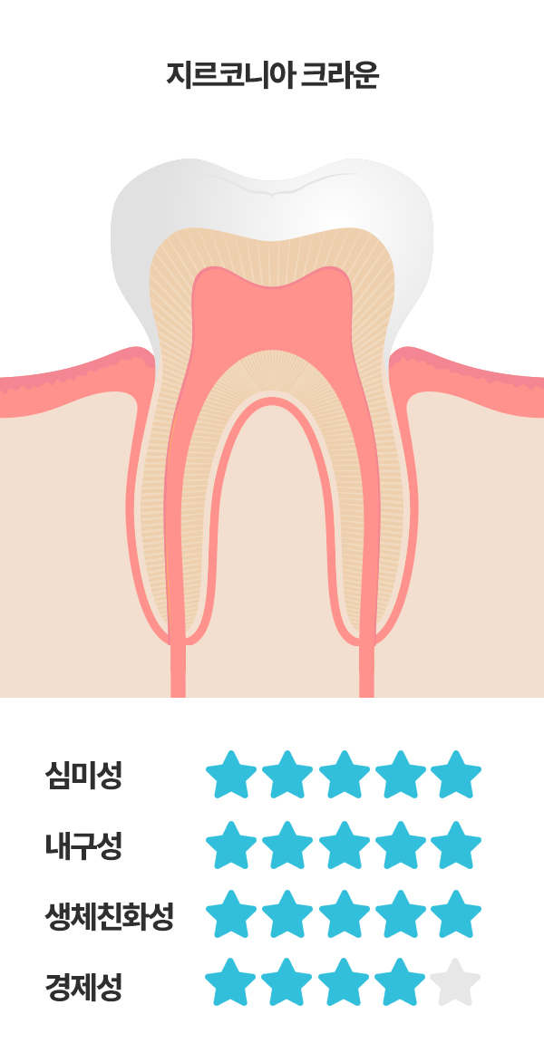 신경치료
